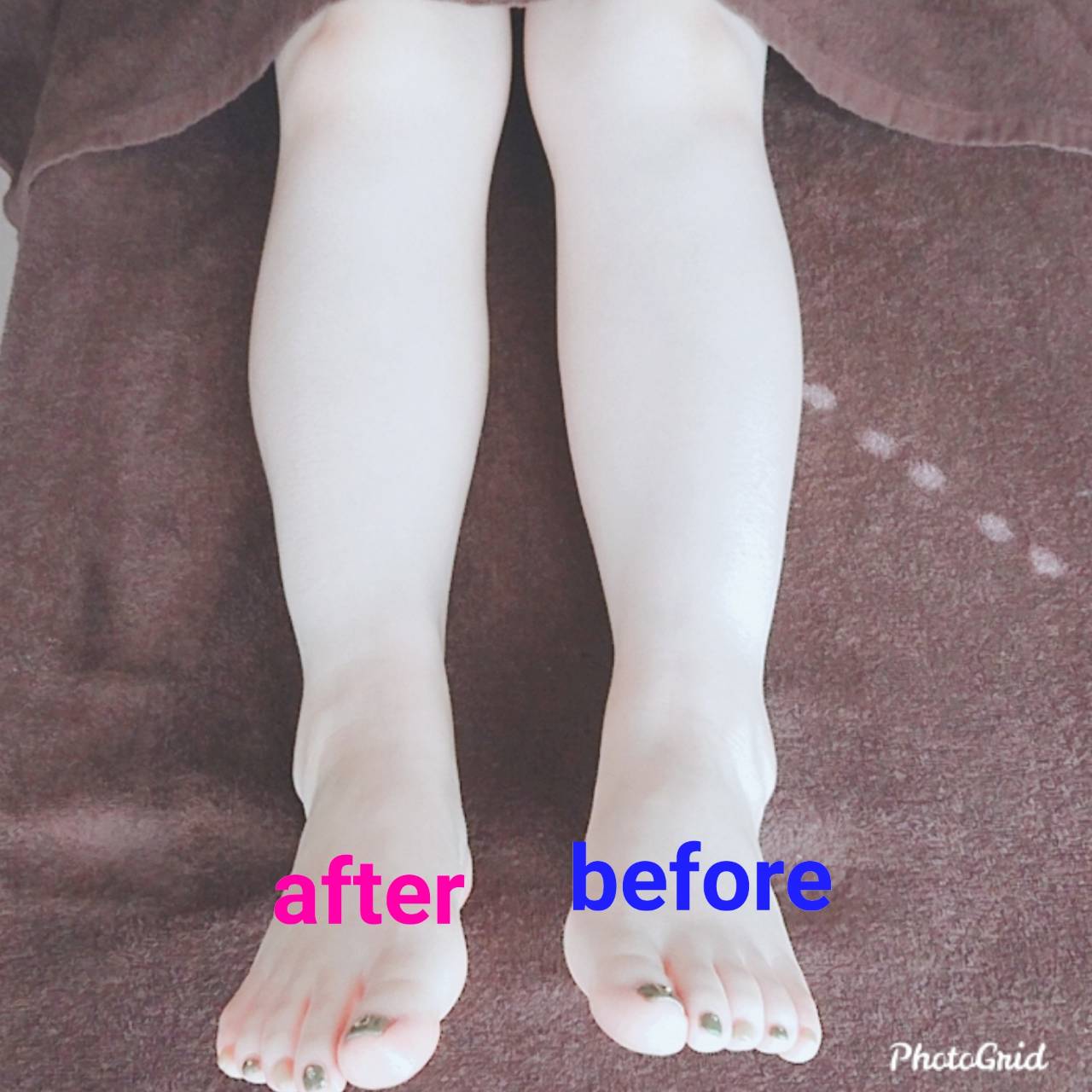 リンパケアで内側からキレイに…