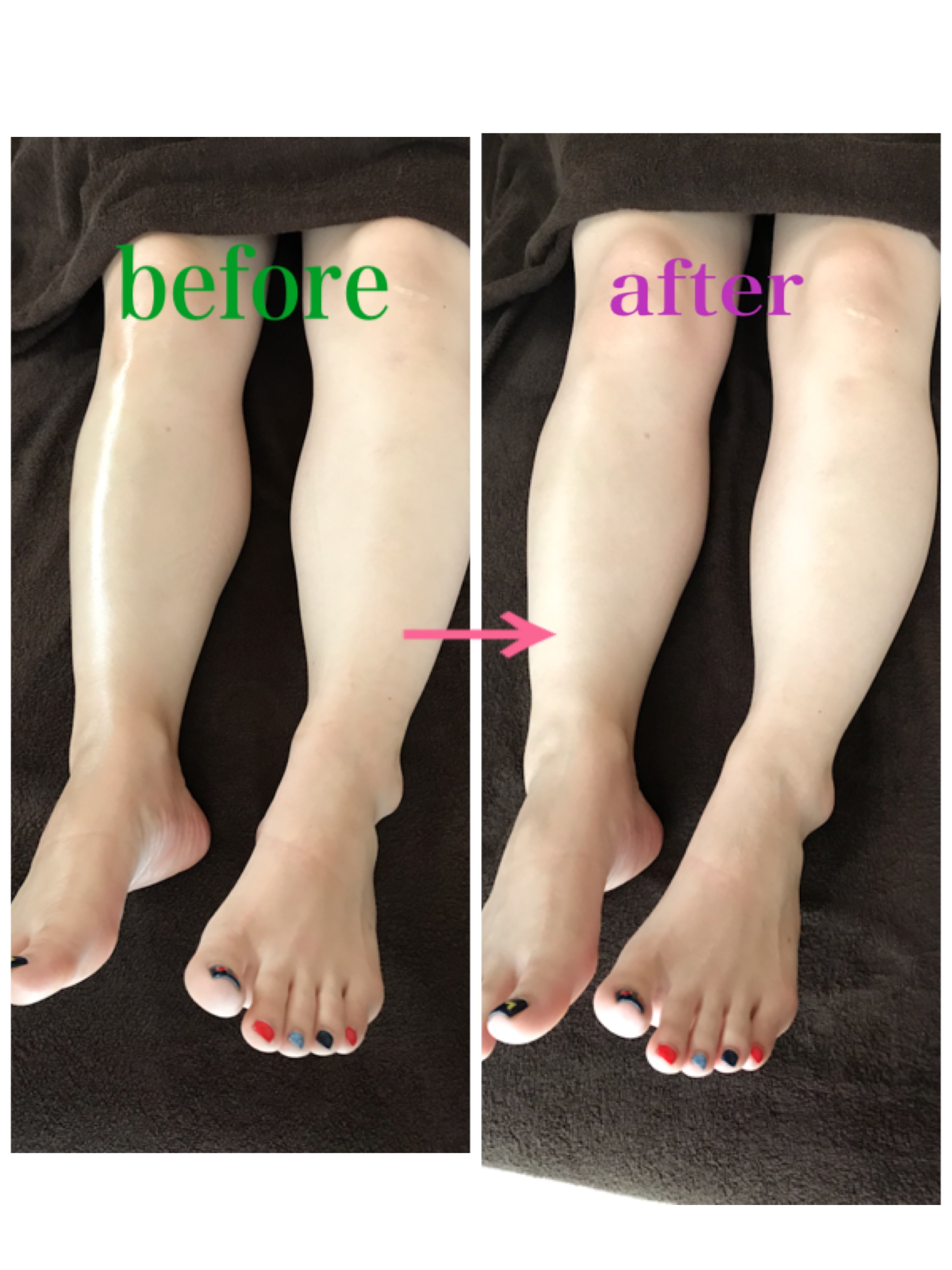 脚のダルさもリンパケアで✨
